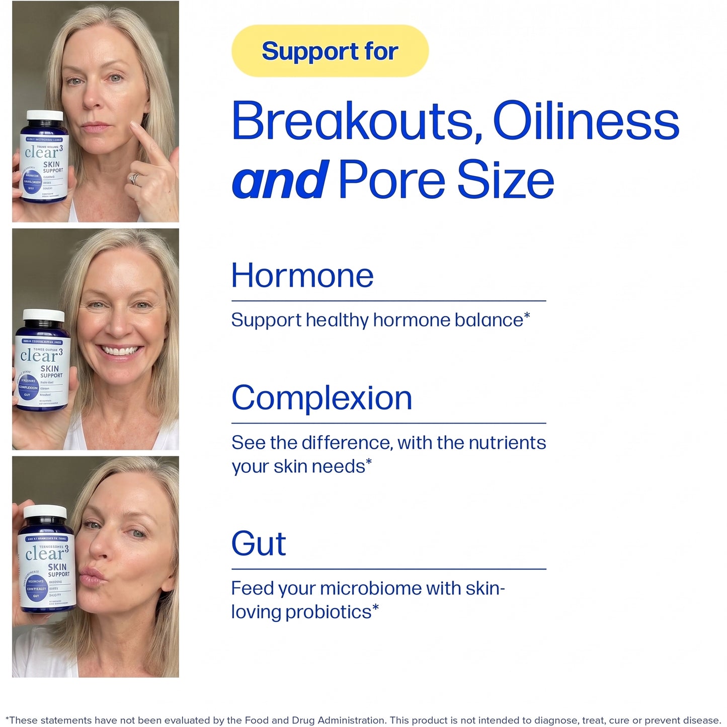 Women’s Hormonal Acne Support