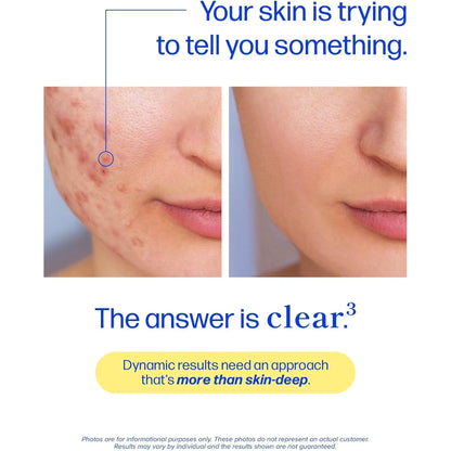 Women’s Hormonal Acne Support